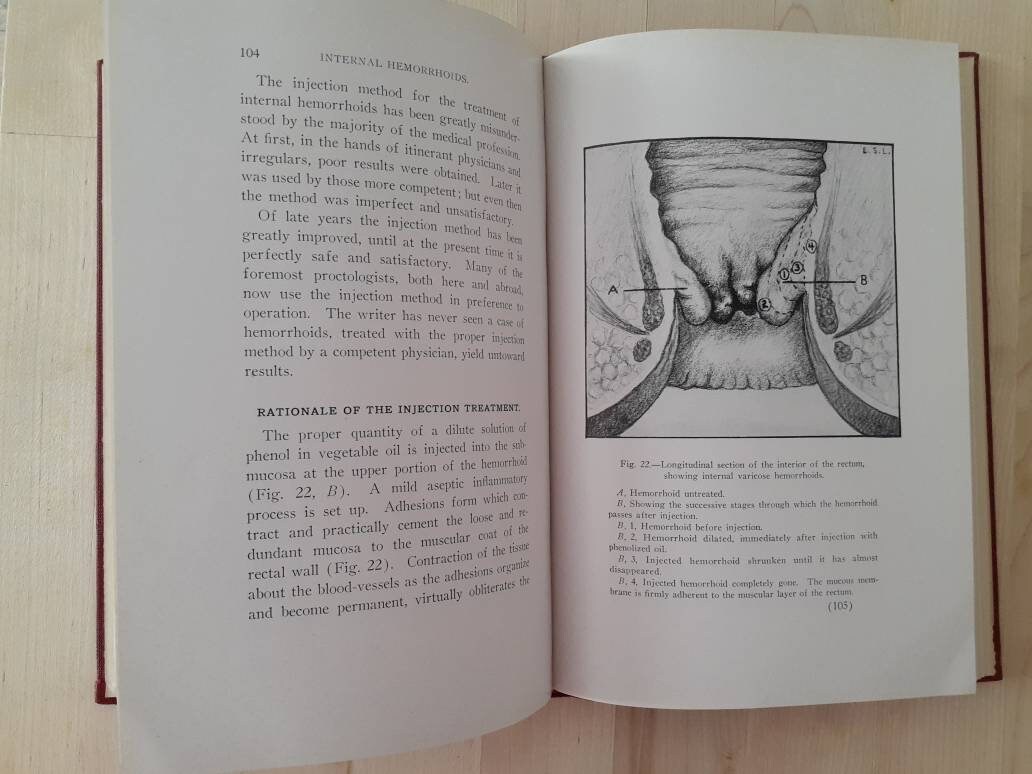 1931 Hemorrhoids the Injection Treatment and Pruritus Ani by Etsy