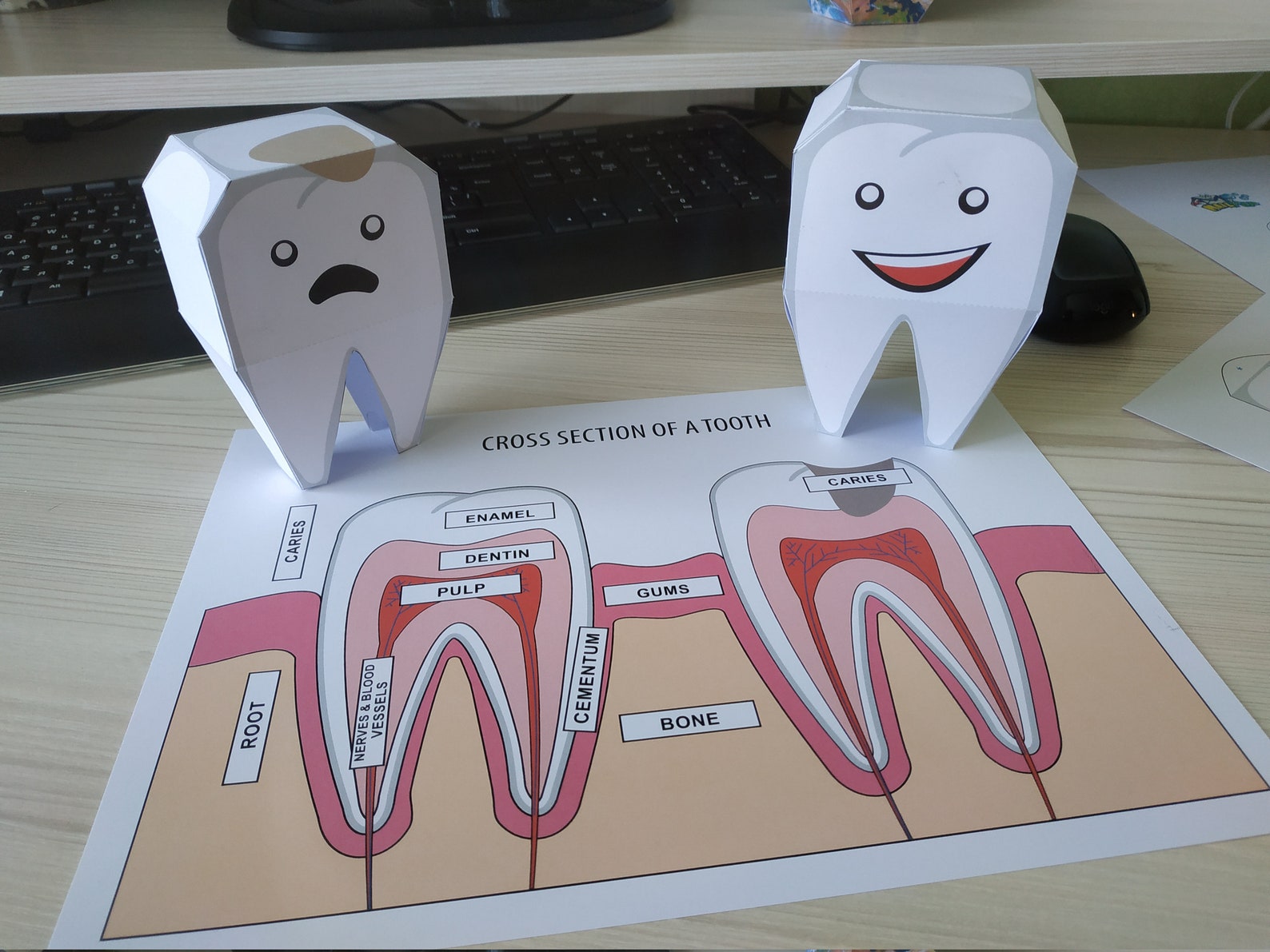 DIY Paper Craft Teeth 3D Healthy Tooth and Carious Tooth Etsy