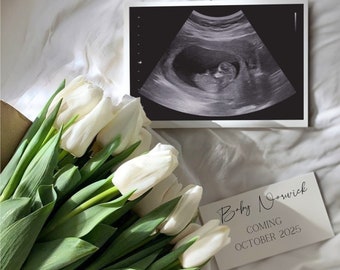 BEWERKBARE eenvoudige lente zwangerschap aankondiging | Aankondiging van de zomerzwangerschap | Digitale babyaankondiging | Geslachtsneutrale baby onthullen CANVA