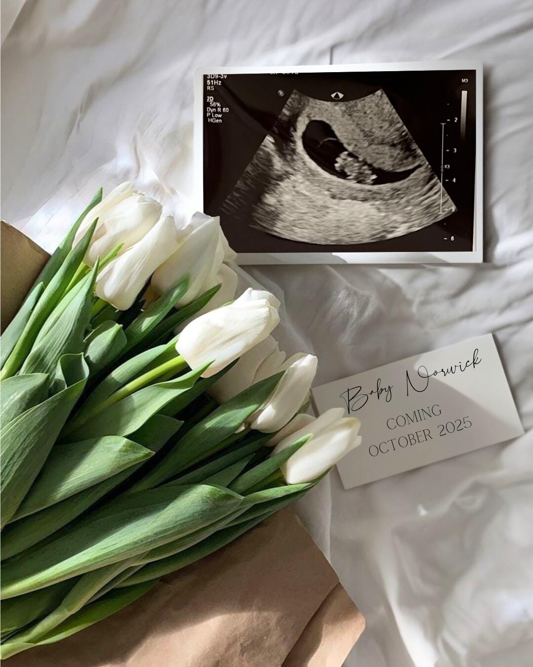 EDITABLE Realistic Simple Pregnancy Announcement | Pregnancy Announcement | Digital Baby Announcement | Gender Neutral Baby Reveal CANVA