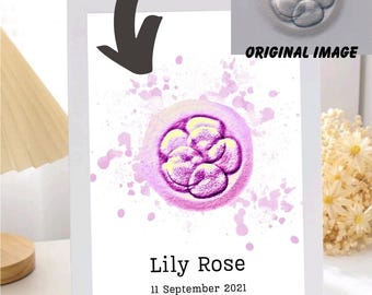 Custom Embryo Watercolor Art, Personalized IVF Gift (Digital Download)