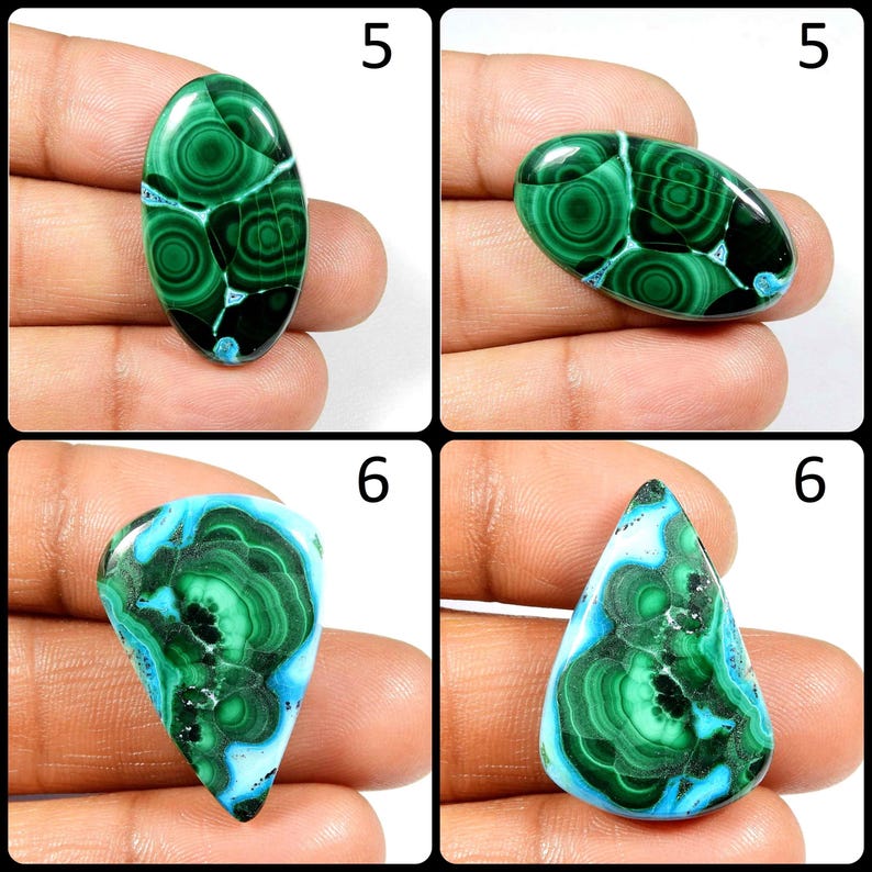 May include: Four Malachite cabochons in various shapes and sizes. The cabochons are green with blue and black accents. The cabochons are displayed on a hand.