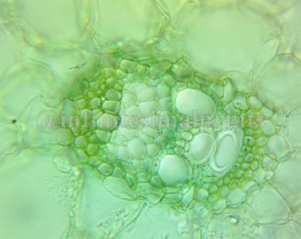 Silver Berry Scaly Hair Print Microscope Print 12x16 Etsy