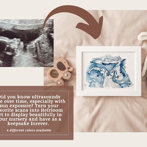 Heirloom Ultrasound or Sonogram Watercolor Painting Baby Ultrasound Art, Nursery Decor, Ultrasound Scan, Sonogram Art image 2
