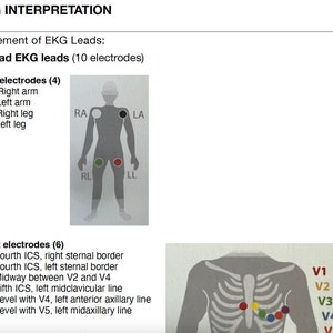 EKG Interpretation Guide / Heart Rhythms / EKG guide