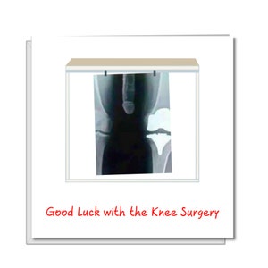 Knee Replacement Surgery Card - Get Well Soon Card, Recovery, Congratulations Funny, humorous, fun Recover