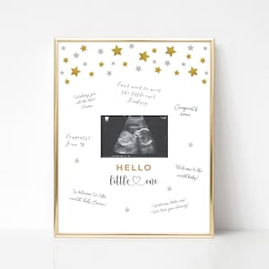 Signo de foto de sonograma de revelación de género, signo de ultrasonido de baby shower, tema Twinkle Twinkle Little Star, libro de visitas alternativo de baby shower