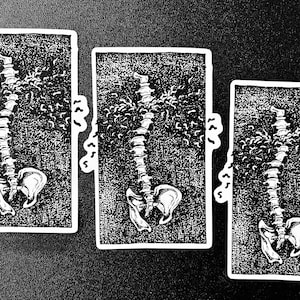 May include: Three black and white illustrations of a human spine with a detailed anatomical drawing of the bones and surrounding tissue.