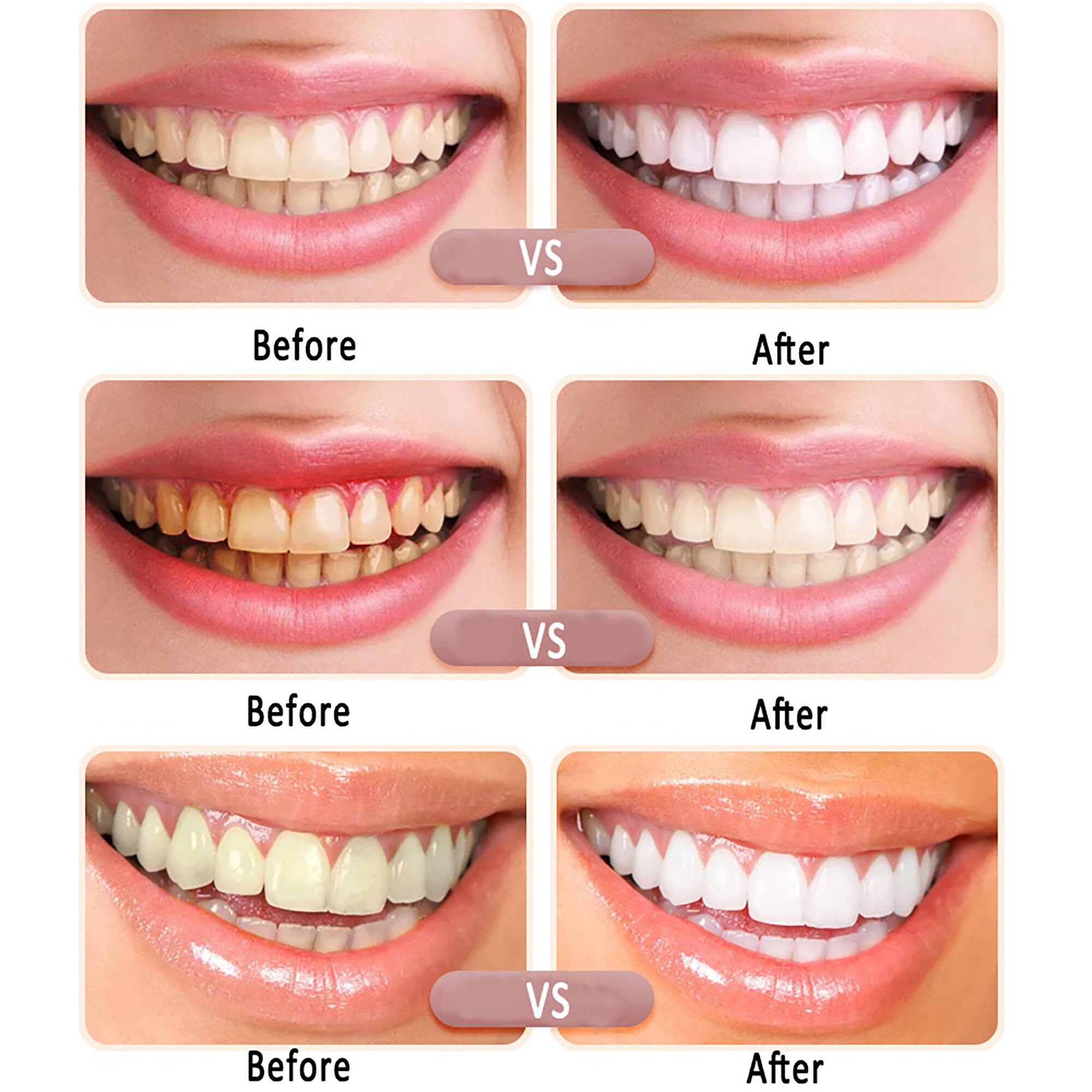 Teeth Whitening Kit with led Light Include Teeth Whitening Etsy