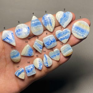 May include: A collection of seventeen polished gemstones in various shapes, including round, heart, teardrop, and square. The stones feature a striking blue and white banded pattern, with some displaying hints of yellow. The gemstones are held in a hand.