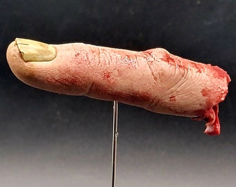 Severed finger