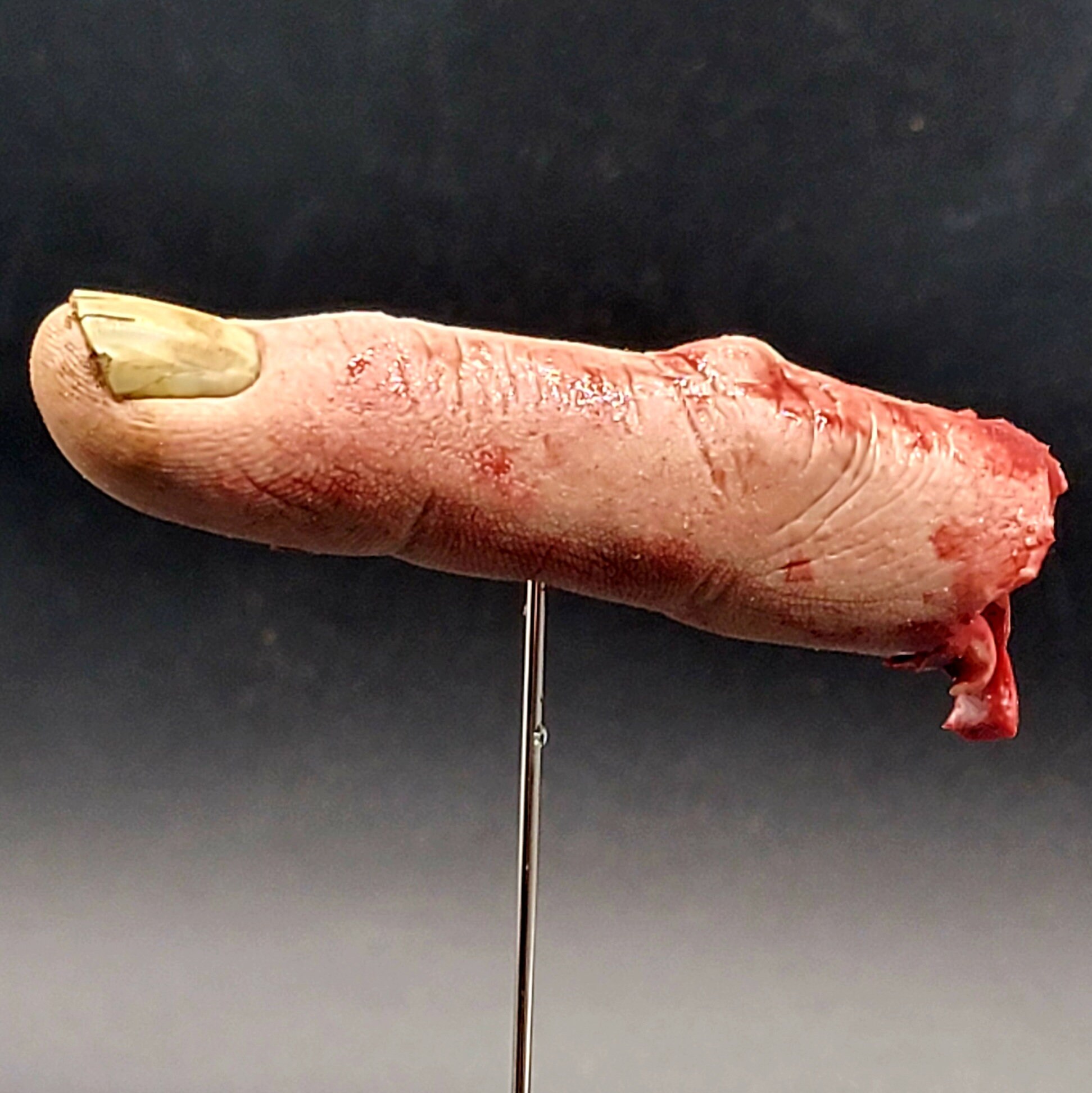 Severed finger