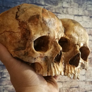 Conjoined Twins Human Skull **FREE SHIPPING*