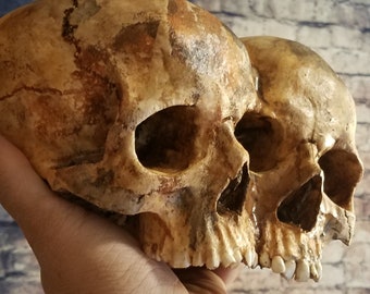 Conjoined Twins Human Skull **FREE SHIPPING*