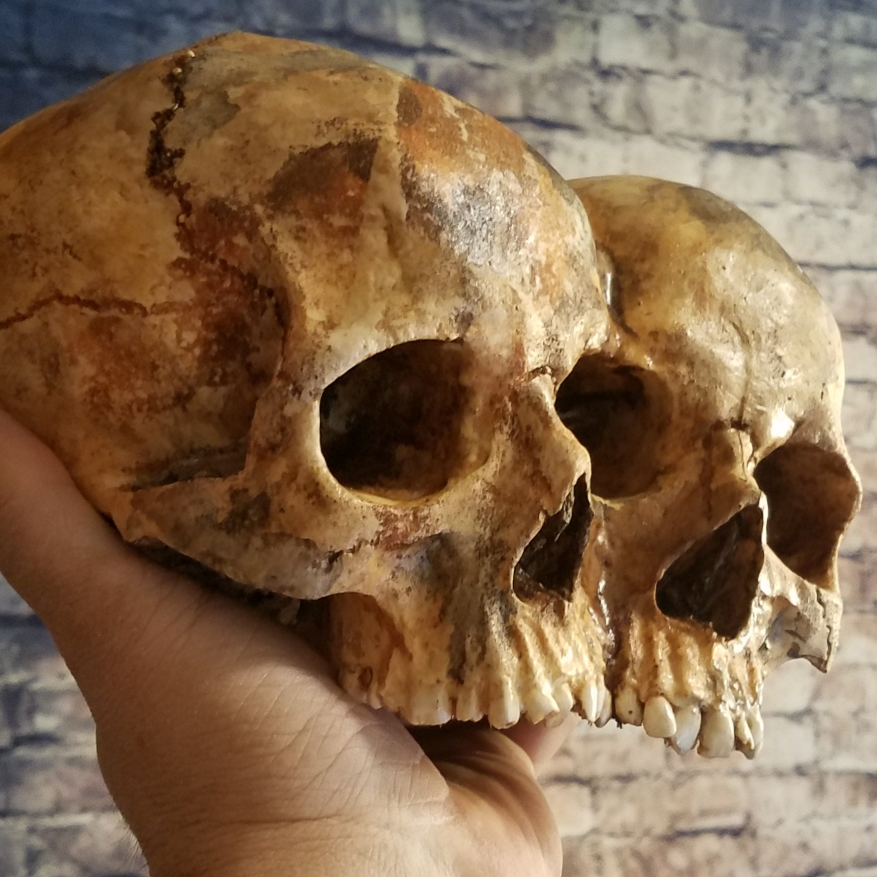 Conjoined Twins Human Skull **FREE SHIPPING*