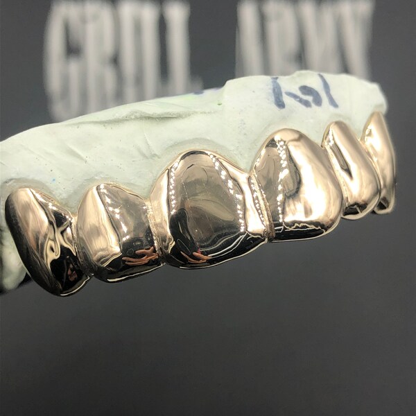 Gold Grillz Etsy