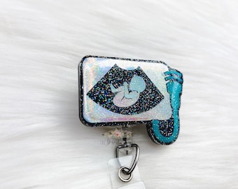 Ultrasound Baby Badge Reel: Glitter Nurse Retractable ID Holder