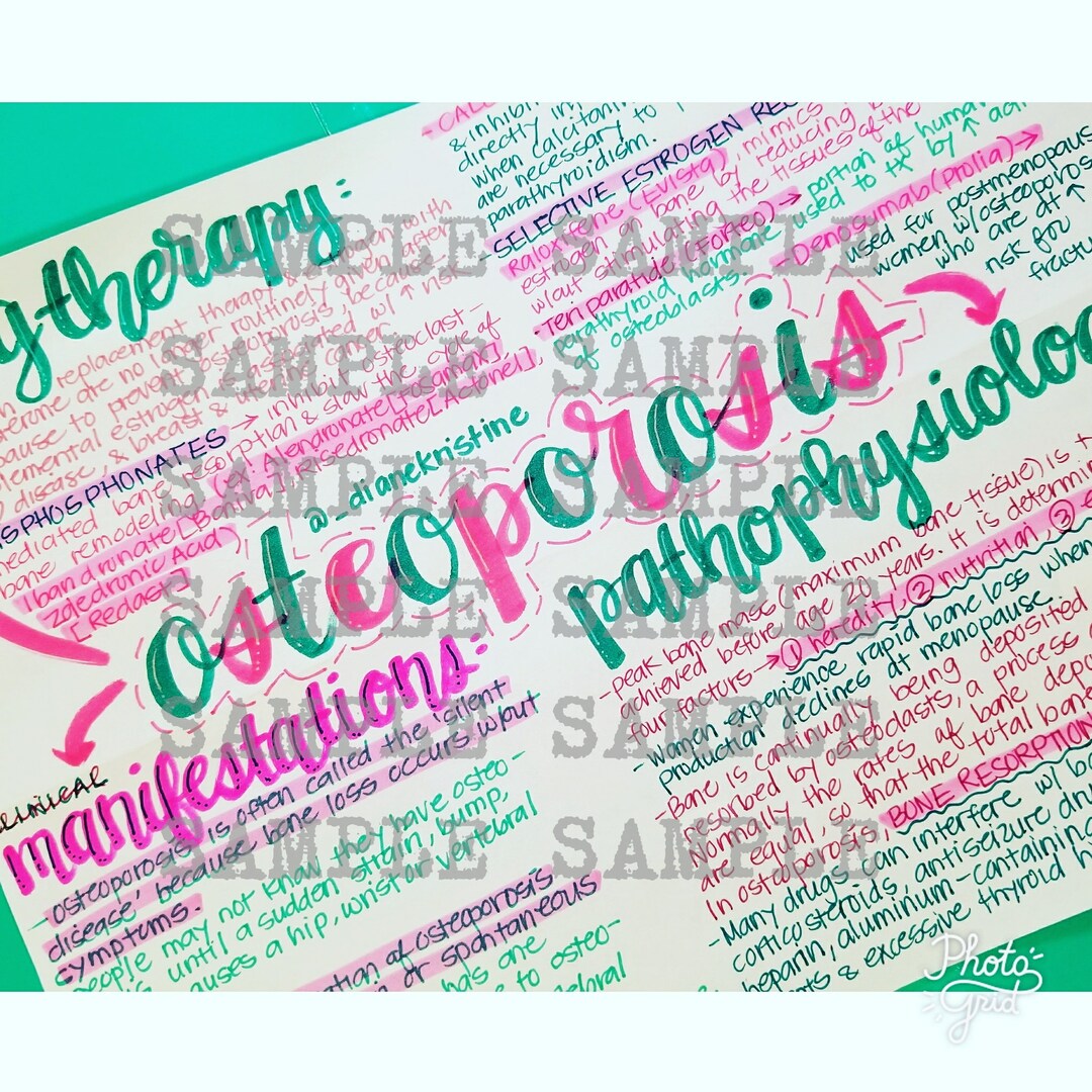 Osteoporosis- Nursing Notes/ Concept Map- Medical Surgiccal Semester - Etsy