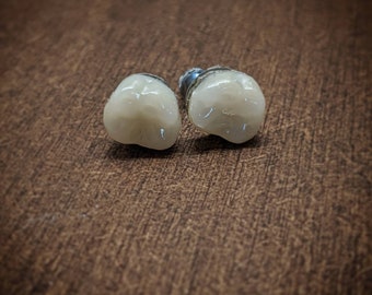 May include: Two white dental crowns with metal posts, on a brown wooden surface.