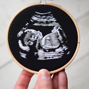4 inch Custom Embroidered Ultrasound. Pregnancy Keepsake. Embroidery Sonogram. Nursery Decor. Baby Shower Gift. Ultrasound Embroidery image 3