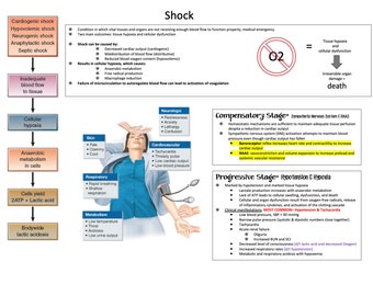 Shock Overview: SHOCK Nursing Student Study Guide