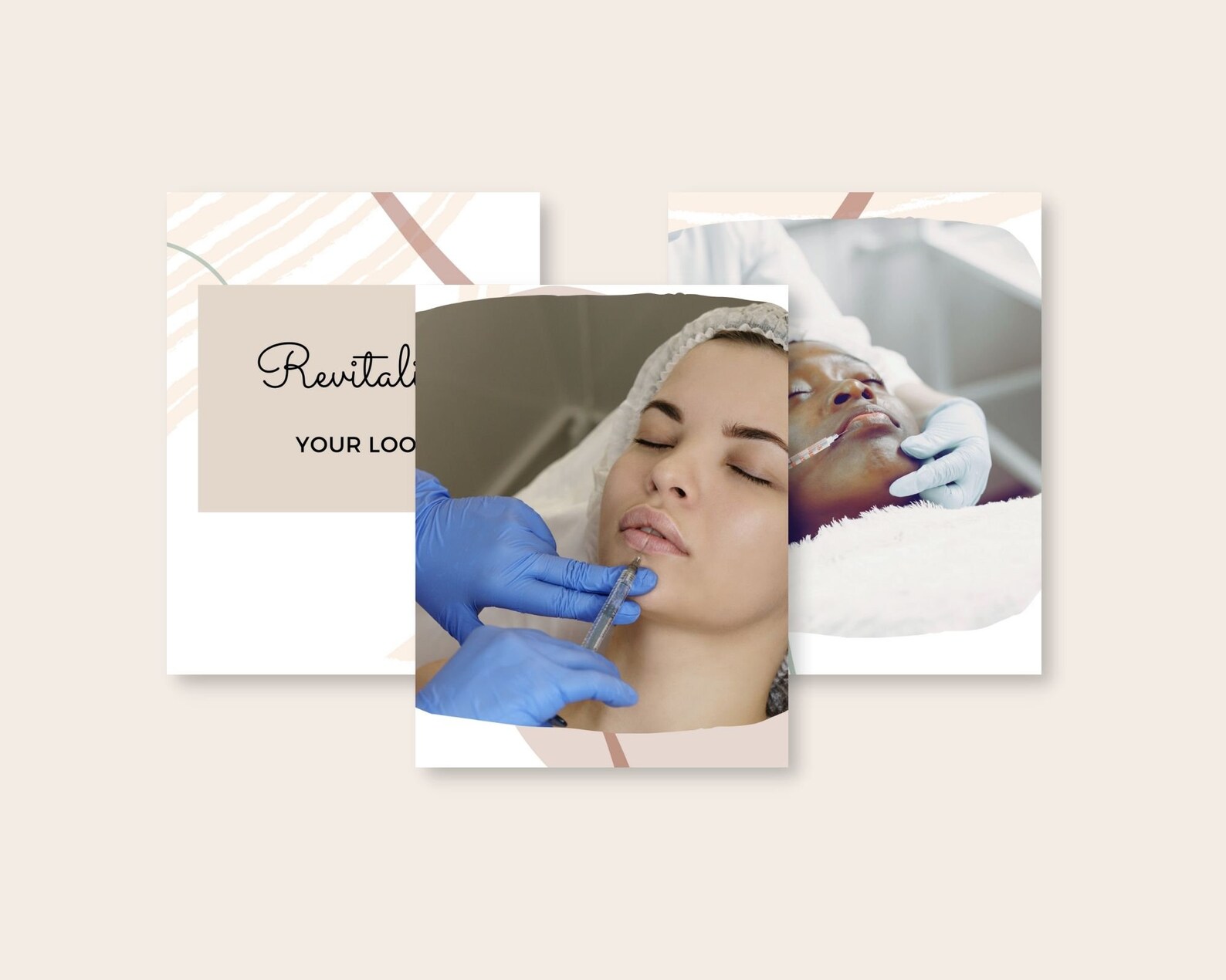 Nurse Injector Templates | Botox and Filler Instagram Posts | Anti ...