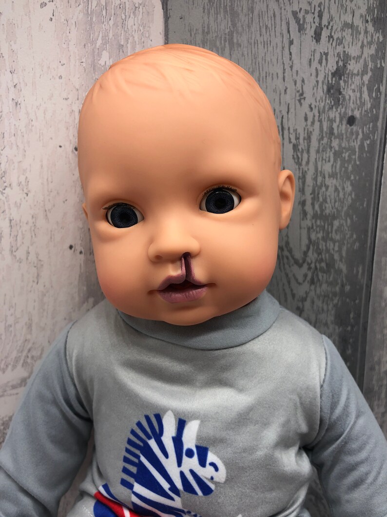 Cleft Lip Doll Pink Clothing Custom Made Add Hearing Aids Etsy