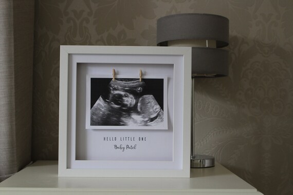 personalised scan frames