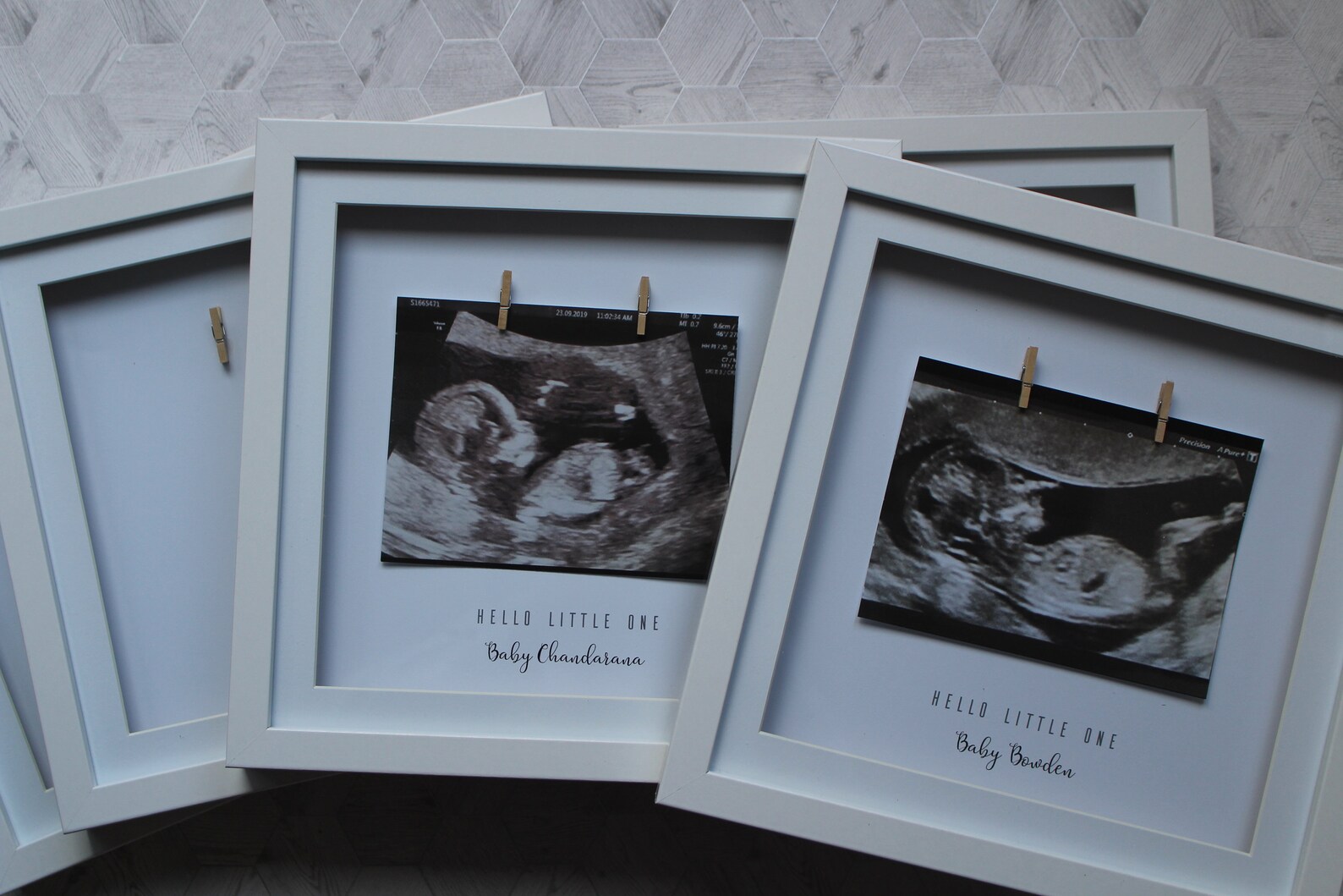 Personalised Scan Mum To-be Frames - Etsy