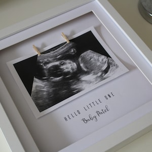 Puede incluir: Un marco de fotos blanco con una imagen de ultrasonido en blanco y negro en su interior. La imagen se mantiene en su lugar con pinzas para la ropa. El texto "HELLO LITTLE ONE Baby Patel" está impreso debajo de la imagen.