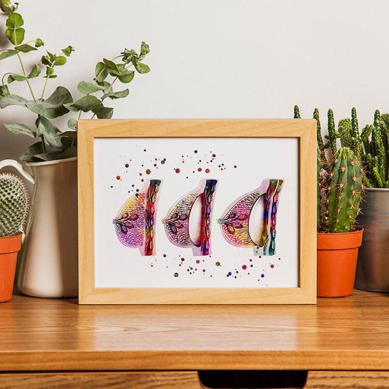 Female Breast Augmentation watercolor print, plastic surgeon gift, plastic surgery image 5