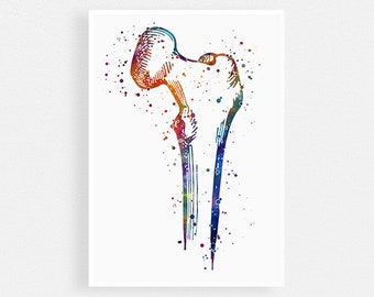 Femur bone watercolor print, Femoral head, Orthopedic art print, Human anatomy art poster