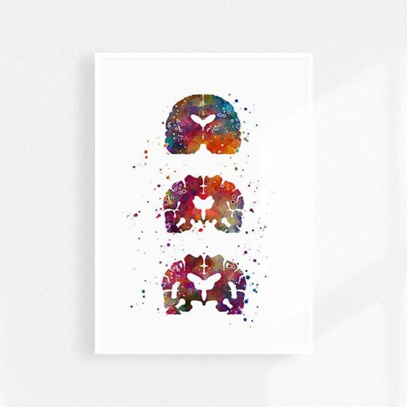 Alzheimers Disease, Neurology Art, Neurologist office decor, Alzheimers Brain Medical Poster for Clinic Wall Decoration, Colorful Artwork image 2