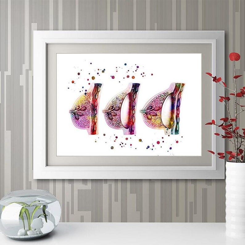 Female Breast Augmentation watercolor print, plastic surgeon gift, plastic surgery image 6