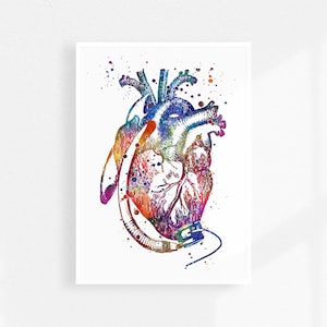 Hart met linkerventrikelhulpapparaat - LVAD-implantaatchirurgie
