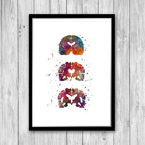 Alzheimers Disease, Neurology Art, Neurologist office decor, Alzheimers Brain Medical Poster for Clinic Wall Decoration, Colorful Artwork image 3
