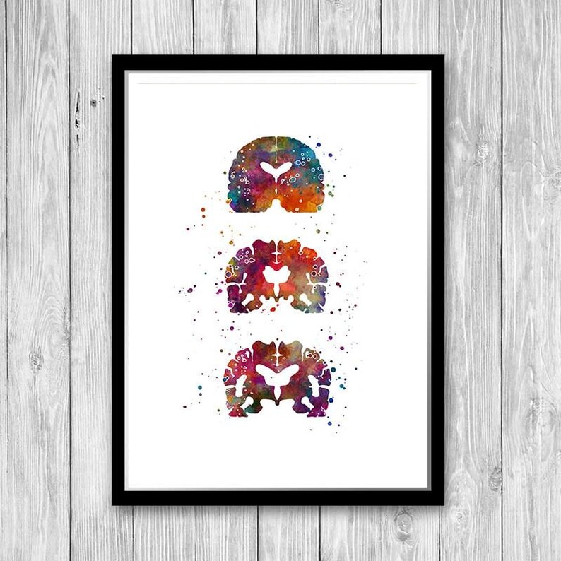 Alzheimers Disease, Neurology Art, Neurologist office decor, Alzheimers Brain Medical Poster for Clinic Wall Decoration, Colorful Artwork image 3