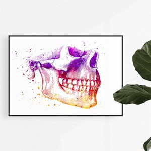 Lower and Upper Jaw Anatomical Art Print, Orthognathic Surgery Medical Poster, Dental Clinic Decor