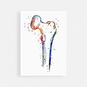 Stampa ad acquerello dell&#39;osso del femore, testa del femore, stampa d&#39;arte ortopedica, poster d&#39;arte di anatomia umana