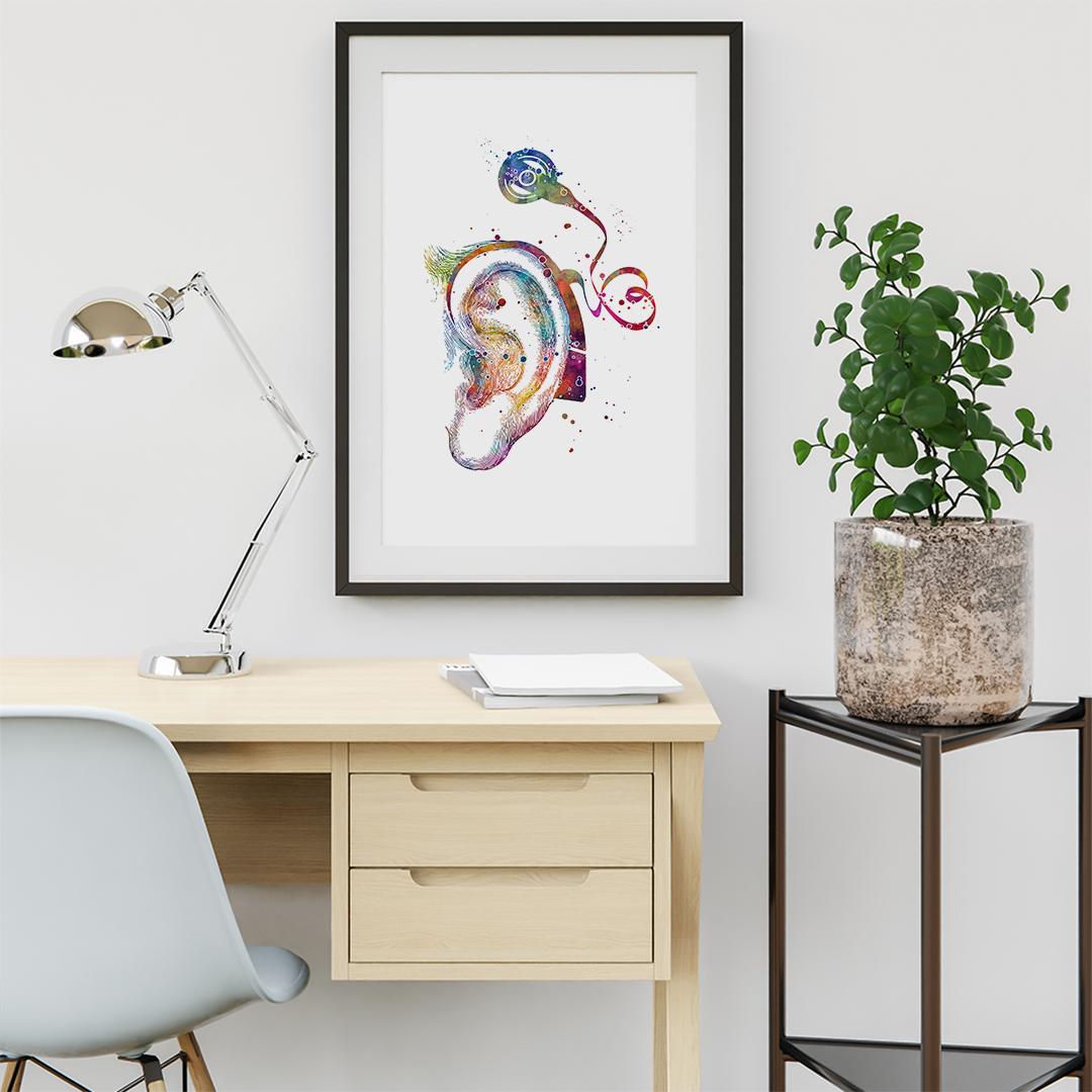 Cochlear Implant Print, Hearing Loss Wall Art, Audiologist Gift, Speech ...