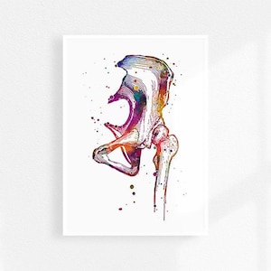 Impresión de acuarela de articulación de la cadera, cirugía ortopédica, póster de arte médico, impresión de anatomía humana