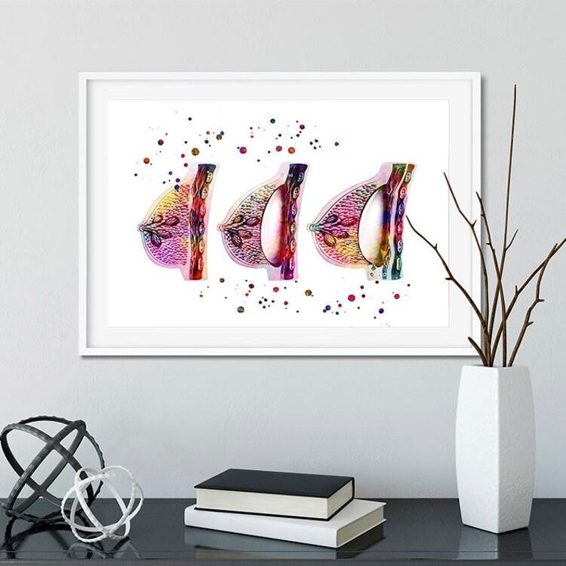 Female Breast Augmentation watercolor print, plastic surgeon gift, plastic surgery image 2