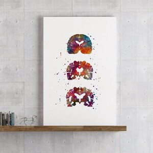 Alzheimers Disease, Neurology Art, Neurologist office decor, Alzheimers Brain Medical Poster for Clinic Wall Decoration, Colorful Artwork image 4