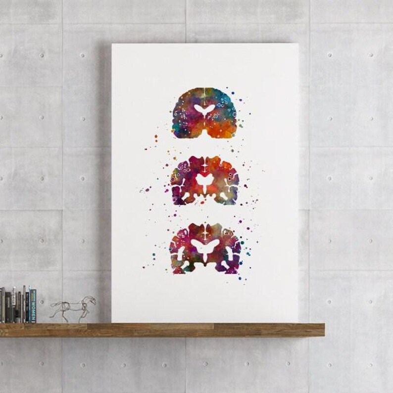 Alzheimers Disease, Neurology Art, Neurologist office decor, Alzheimers Brain Medical Poster for Clinic Wall Decoration, Colorful Artwork image 4