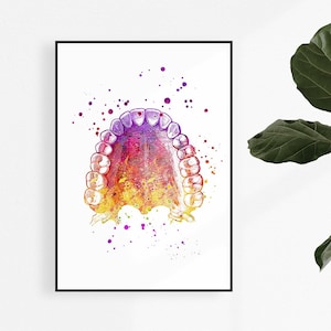 Upper Teeth and Palate Dental Art Print, Dentist Office Wall Decor, Educational Poster