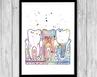 Dental implant art Dentist office decor Dental anatomy print Dentist gift for women Tooth implant medical poster