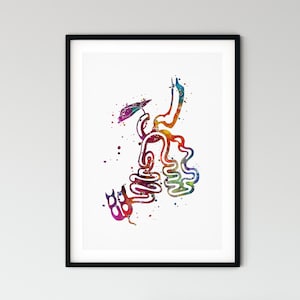 Bariatric Clinic Wall Art, SADI-S Print, Duodenal Switch Surgery Poster, Doctor office art decor
