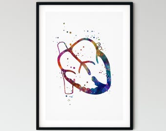VSD Heart Defect Art Print, Ventricular Septal Defect Poster, CHD Awareness Gift, Pediatric Cardiology Wall Decor