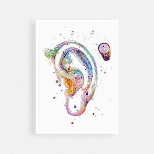 Bone anchored hearing aid BAHA Audiology Art Watercolor Print Audiologist Gift Doctor Office Decor, hearing implants