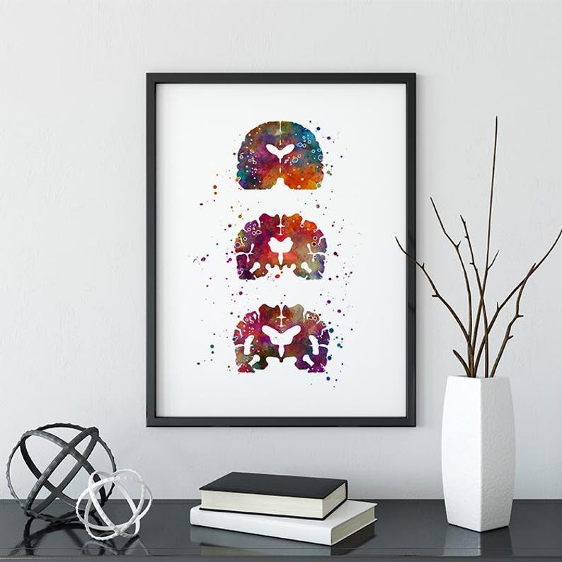 Alzheimers Disease, Neurology Art, Neurologist office decor, Alzheimers Brain Medical Poster for Clinic Wall Decoration, Colorful Artwork image 1